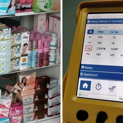 LGUs Urged to Fight Proliferation of Mercury-Adulterated Cosmetics in the Market